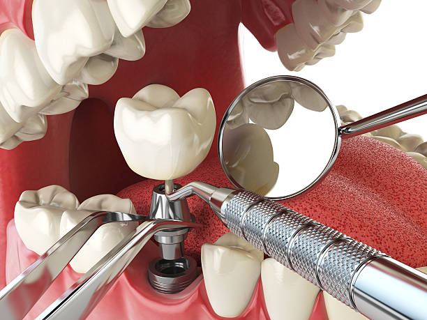 Best Broken Tooth Emergency  in Castle Pines, CO